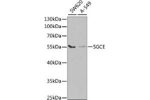 Western blot analysis of extracts of various cell lines, using SGCE antibody (ABIN6132885, ABIN6147703, ABIN6147704 and ABIN6220961) at 1:1000 dilution. (SGCE antibody  (AA 1-317))