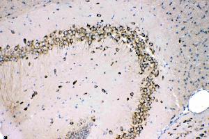 MPS1 was detected in paraffin-embedded sections of mouse brain tissues using rabbit anti- MPS1 Antigen Affinity purified polyclonal antibody (Catalog # ) at 1 µg/mL. (RPS27 antibody  (AA 2-84))