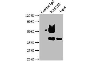Immunoprecipitating RASSF2 in Raji whole cell lysate Lane 1: Rabbit control IgG instead of ABIN7167126 in Raji whole cell lysate. (RASSF2 antibody  (AA 69-326))
