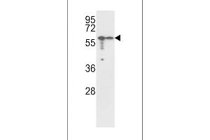 Western blot analysis of Vimentin Antibody (Center) (ABIN389213 and ABIN2839368) in , cell line lysates (35 μg/lane). (Vimentin antibody  (AA 152-181))