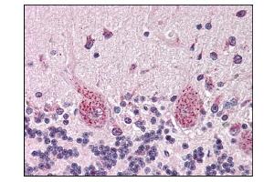 Image no. 1 for anti-Retinoblastoma-Like 2 (p130) (RBL2) (C-Term) antibody (ABIN303139) (p130 antibody  (C-Term))