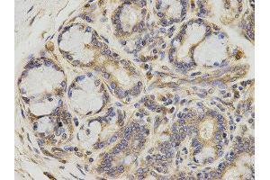 Immunohistochemistry (IHC) image for anti-5-Aminoimidazole-4-Carboxamide Ribonucleotide Formyltransferase/IMP Cyclohydrolase (ATIC) antibody (ABIN1876739) (ATIC antibody)