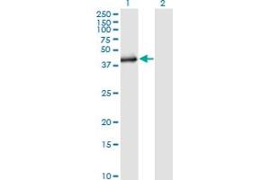 Western Blot analysis of SGK2 expression in transfected 293T cell line by SGK2 monoclonal antibody (M02), clone 1A7. (SGK2 antibody  (AA 293-367))
