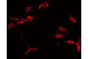 ABIN6267312 staining Hela by IF/ICC. (LCK antibody  (pTyr505))