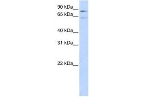 WB Suggested Anti-F13B Antibody Titration:  0. (F13B antibody  (Middle Region))