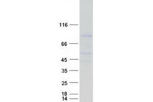 Validation with Western Blot (REC8 Protein (Transcript Variant 1) (Myc-DYKDDDDK Tag))