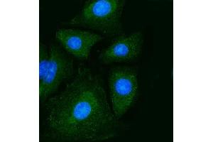 IF analysis of PKM2 using anti-PKM2 antibody (ABIN7603151). (PKM antibody  (N-Term))