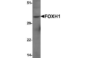 Western Blotting (WB) image for anti-Forkhead Box H1 (FOXH1) (N-Term) antibody (ABIN1077399)