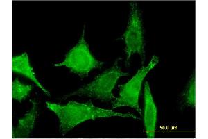 Immunofluorescence of monoclonal antibody to TBCC on HeLa cell. (TBCC antibody  (AA 1-346))