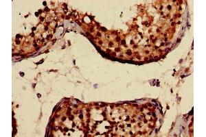 Immunohistochemistry of paraffin-embedded human testis tissue using ABIN7146825 at dilution of 1:100 (CRAT antibody  (AA 181-346))