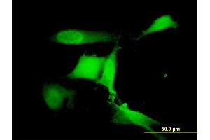 Immunofluorescence of monoclonal antibody to RFWD2 on NIH/3T3 cell. (RFWD2 antibody  (AA 632-731))