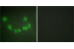 Immunofluorescence analysis of HuvEc cells, using CDC2 Antibody. (CDK1 antibody  (AA 101-150))