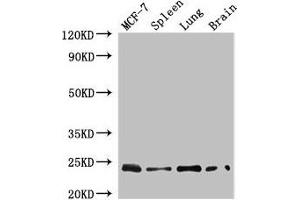 Western Blot Positive WB detected in: MCF-7 whole cell lysate, Mouse spleen tissue, Mouse lung tissue, Mouse brain tissue All lanes: RAB25 antibody at 4 μg/mL Secondary Goat polyclonal to rabbit IgG at 1/50000 dilution Predicted band size: 24 kDa Observed band size: 24 kDa (RAB25 antibody  (AA 1-210))