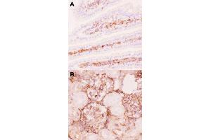 Immunohistochemical staining (Frozen sections) of mouse intestine tissue (A) and rat kidney tissue (B) with ABCB1 polyclonal antibody  under 0. (ABCB1 antibody  (AA 621-650))