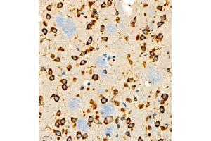 Immunohistochemistry of paraffin embedded rat brain using P4H (ABIN7074215) at dilution of 1:700 (400x lens) (HIF Prolyl Hydroxylase antibody)