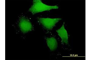 Immunofluorescence of purified MaxPab antibody to MBIP on HeLa cell. (MBIP antibody  (AA 1-343))