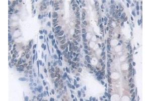 Immunohistochemistry (IHC) image for anti-Transketolase (TKT) (AA 1-286) antibody (ABIN7441421)