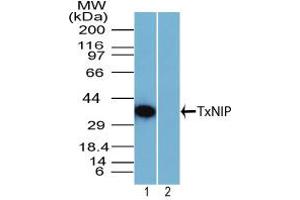 Image no. 1 for anti-Thioredoxin Interacting Protein (TXNIP) (AA 100-150) antibody (ABIN960393)