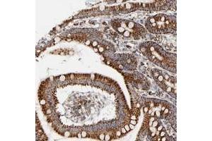 Immunohistochemical staining of human small intestine with C14orf135 polyclonal antibody  shows strong cytoplasmic positivity, with a granular pattern, in glandular cells at 1:200-1:500 dilution. (PCNXL4 antibody)