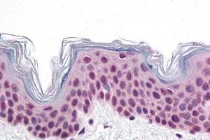 Human Skin: Formalin-Fixed, Paraffin-Embedded (FFPE) (CDC27 antibody  (C-Term))