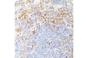 Immunohistochemistry (IHC) image for anti-Receptor (TNFRSF)-Interacting serine-threonine Kinase 1 (RIPK1) (AA 170-440) antibody (ABIN6146959)