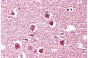 Brain, cortex, Human: Formalin-Fixed, Paraffin-Embedded (FFPE) (ADGRV1 / GPR98 antibody  (Internal Region))