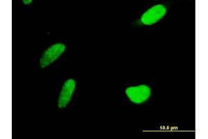 Immunofluorescence of purified MaxPab antibody to PAPSS2 on HeLa cell. (PAPSS2 antibody  (AA 1-614))