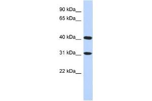 Western Blotting (WB) image for anti-Family with Sequence Similarity 46, Member D (FAM46D) antibody (ABIN2459624) (FAM46D antibody)