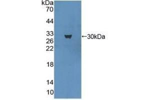 Detection of Recombinant MAP1A, Mouse using Polyclonal Antibody to Microtubule Associated Protein 1A (MAP1A) (MAP1A antibody  (AA 2552-2759))