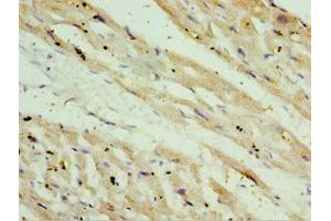 Immunohistochemistry of paraffin-embedded human heart tissue using ABIN7170926 at dilution of 1:100 (OXCT1 antibody  (AA 261-520))