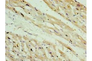 Immunohistochemistry of paraffin-embedded human heart tissue using ABIN7170926 at dilution of 1:100