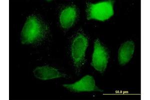 Immunofluorescence of purified MaxPab antibody to BCAP31 on HeLa cell. (BCAP31 antibody  (AA 1-246))