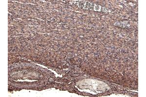 Immunohistochemistry (IHC) image for anti-NK2 Homeobox 5 (NKX2-5) (Internal Region) antibody (ABIN570994)