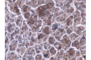 DAB staining on IHC-P; Samples: Mouse Stomach Tissue (MRPL1 antibody  (AA 143-336))