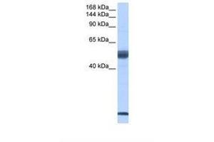 Image no. 1 for anti-Pre-mRNA Branch Site Protein p14 (SF3B14) (C-Term) antibody (ABIN6737953) (Pre-mRNA Branch Site Protein p14 (SF3B14) (C-Term) antibody)