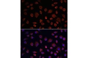 Immunofluorescence analysis of L929 cells using ULK1 antibody (ABIN6134005, ABIN6149921, ABIN6149922 and ABIN6224624) at dilution of 1:100. (ULK1 antibody  (AA 400-499))
