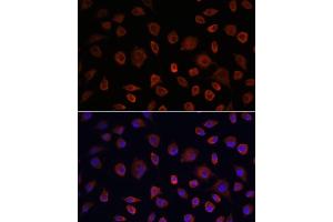 Immunofluorescence analysis of L929 cells using ULK1 antibody (ABIN6134005, ABIN6149921, ABIN6149922 and ABIN6224624) at dilution of 1:100. (ULK1 antibody  (AA 400-499))