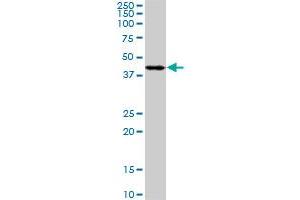 PDK2 monoclonal antibody (M02), clone 5F8. (PDK2 antibody  (AA 187-276))