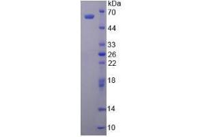 Image no. 1 for Aldehyde Dehydrogenase 1 Family, Member A1 (ALDH1A1) (AA 2-501) (Active) protein (His tag) (ABIN6239868)