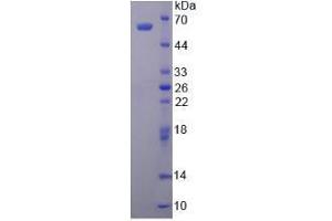 Image no. 1 for Aldehyde Dehydrogenase 1 Family, Member A1 (ALDH1A1) (AA 2-501) (Active) protein (His tag) (ABIN5665760) (ALDH1A1 Protein (AA 2-501) (His tag))
