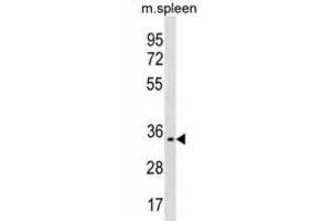 Western Blotting (WB) image for anti-Triggering Receptor Expressed On Myeloid Cells-Like 1 (TREML1) antibody (ABIN3000417) (TREML1 antibody)