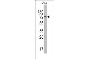 Image no. 1 for anti-Cadherin 5 (CDH5) (N-Term) antibody (ABIN357862) (Cadherin 5 antibody  (N-Term))