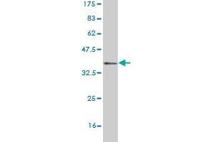 Western Blot detection against Immunogen (36. (ACMSD antibody  (AA 179-278))