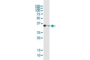 Immunoprecipitation (IP) image for SGCG (Human) IP-WB Antibody Pair (ABIN2752036)