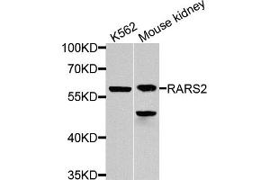 Western blot analysis of extracts of various cell lines, using RARS2 antibody. (RARS2 antibody)