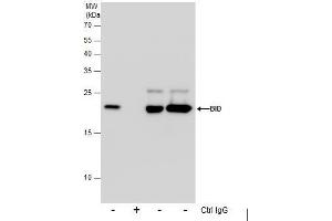 IP Image Immunoprecipitation of Bid protein from Jurkat whole cell extracts using 5 μg of Bid antibody [N1C3] , or Bid antibody [N1C3-2], Western blot analysis was performed using Bid antibody [N1C3], EasyBlot anti-Rabbit IgG  was used as a secondary reagent. (BID antibody)