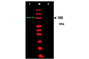 Western blot using BACH1 polyclonal antibody  shows detection of a band at~105 KDa (Lane 1) corresponding to human BACH1 present in a 293 whole cell lysate (arrowhead). (BACH1 antibody  (AA 92-104))