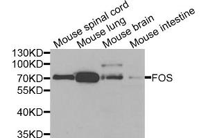 Western blot analysis of extracts of various cell lines, using FOS antibody. (c-FOS antibody)
