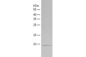 Western Blotting (WB) image for Jumping Translocation Breakpoint (JTB) (AA 31-105) protein (His tag) (ABIN7284677) (JTB Protein (AA 31-105) (His tag))