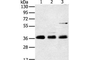 Western Blot analysis of Mouse lung tissue, NIH/3T3 and hepg2 cell using ANKRD1 Polyclonal Antibody at dilution of 1:400 (ANKRD1 antibody)